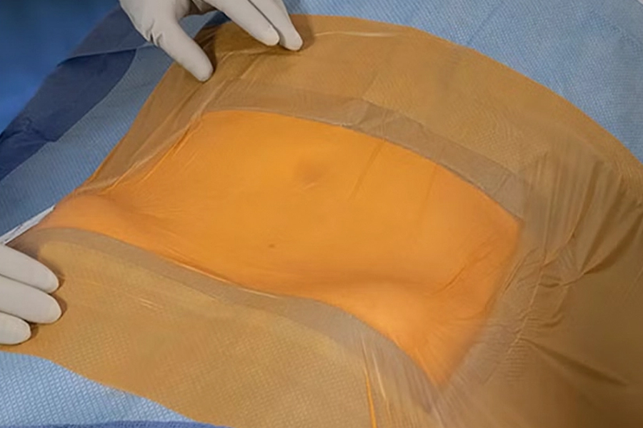 Disposable Adhesive Drapes