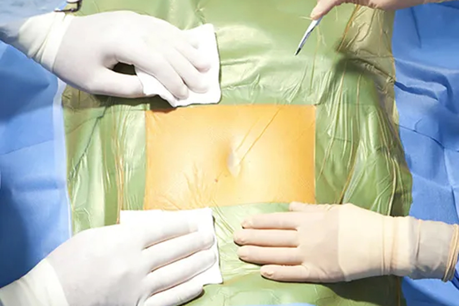 Disposable Adhesive Drapes